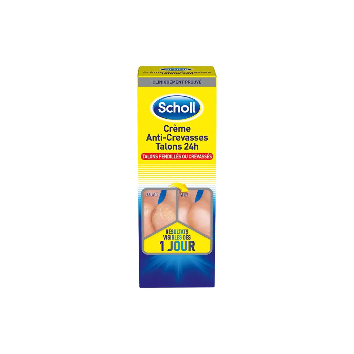 Crème Anti-Crevasses K+ Urée 25% - 2 contenances - Scholl Scholl 