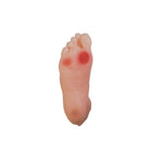 Diabetic foot model - Anatomy and pathology