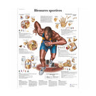 Anatomical board - Sports injuries